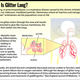 Image for article titled Cases Of Glitter Lung On The Rise Among Elementary-School Art Teachers